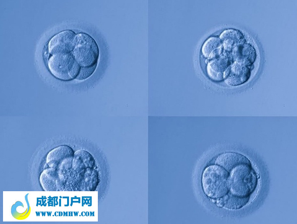 试管序贯移植法适合多次失败的患者